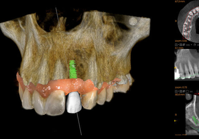 Imagerie 3D : de nouvelles réalités de travail pour les modèles les plus performants